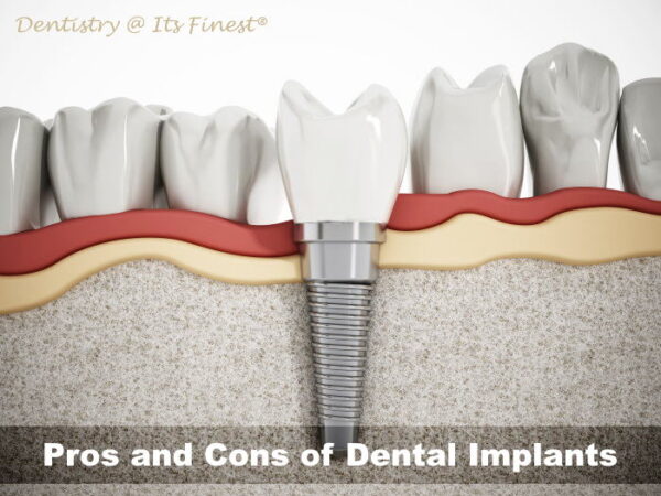 Pros and Cons of Dental Implants - Dentistry At Its Finest